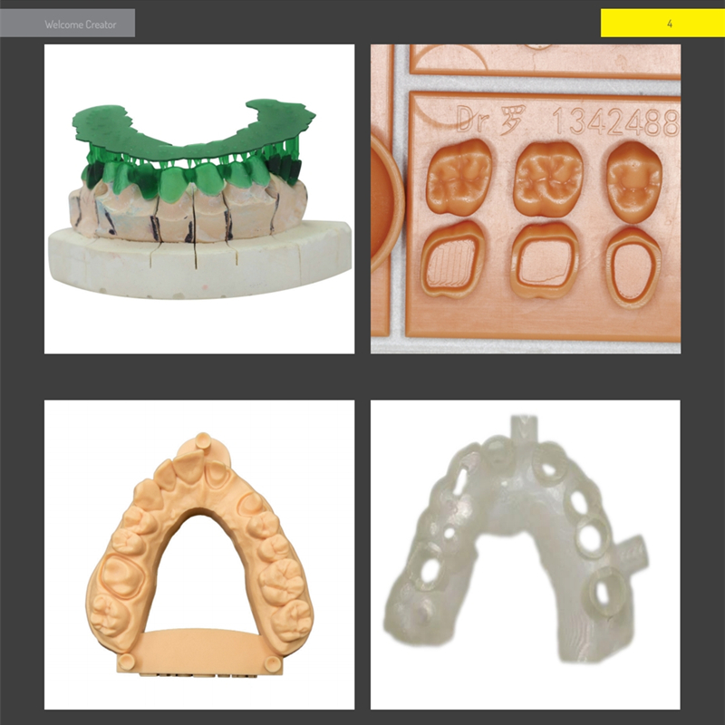 Harz 3d drucker dental casting – 3D Printing Orthodontics Bewertung und Preis