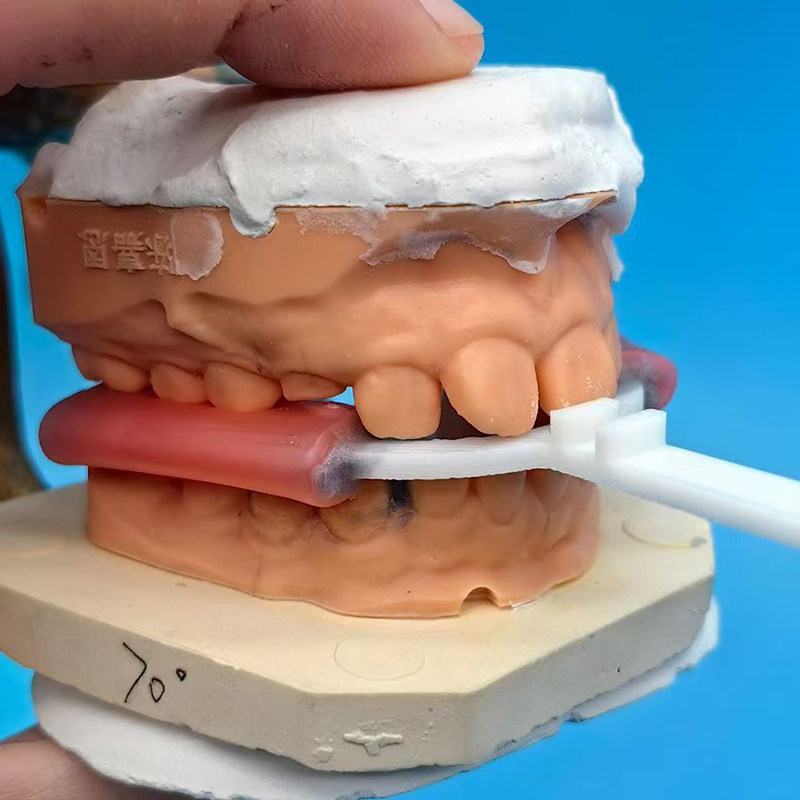 10 Stück/Beutel Dental-Bissgab – 3D Printing Orthodontics Bewertung und Preis