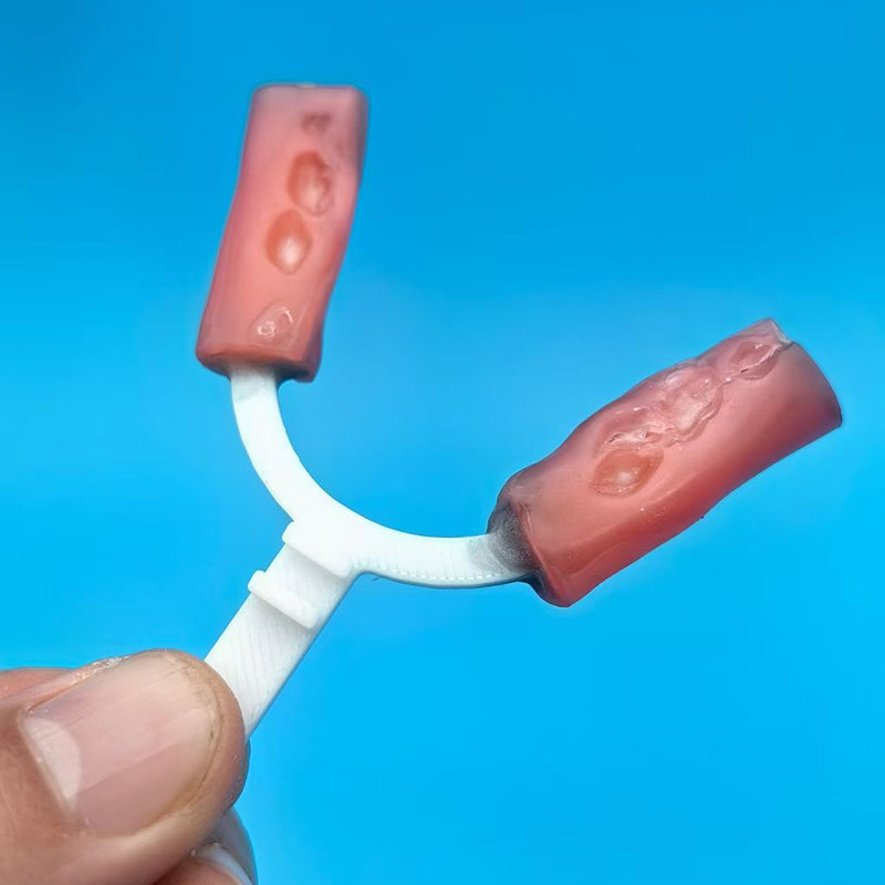10 Stück/Beutel Dental-Bissgab – 3D Printing Orthodontics Bewertung und Preis