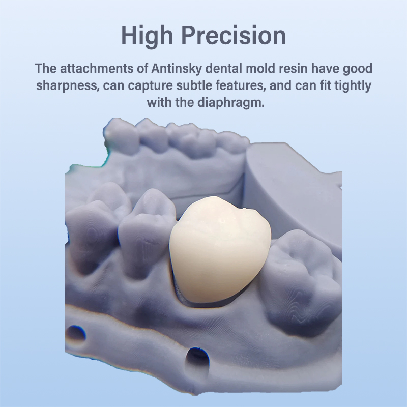 Antinsky Temporäres Zahnmodell – 3D Printing Orthodontics Bewertung und Preis